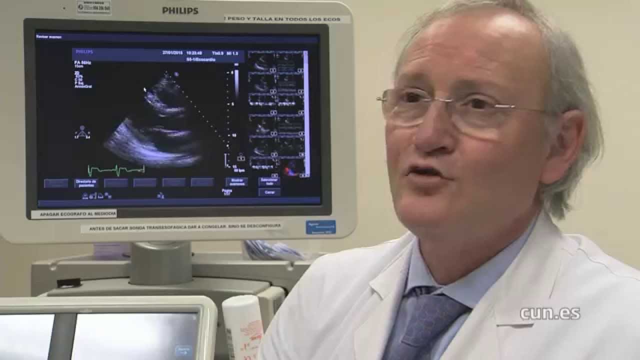 Los beneficios del deporte para el corazón (Clínica Universidad de Navarra) Los beneficios del deporte para el corazón (Clínica Universidad de Navarra)