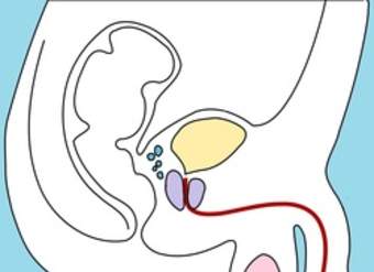 Aparato reproductor masculino Aparato reproductor masculino