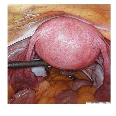 Imagen real del útero Imagen real del útero