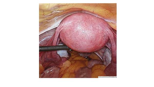 Imagen real del útero Imagen real del útero