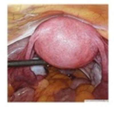 Imagen real del útero Imagen real del útero