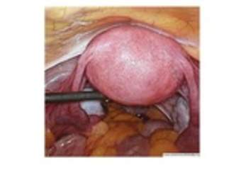 Imagen real del útero Imagen real del útero