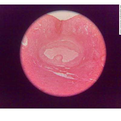 Imagen histológica de ovarios Imagen histológica de ovarios