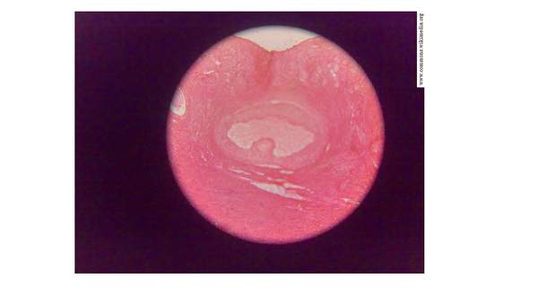 Imagen histológica de ovarios Imagen histológica de ovarios