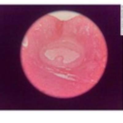 Imagen histológica de ovarios Imagen histológica de ovarios