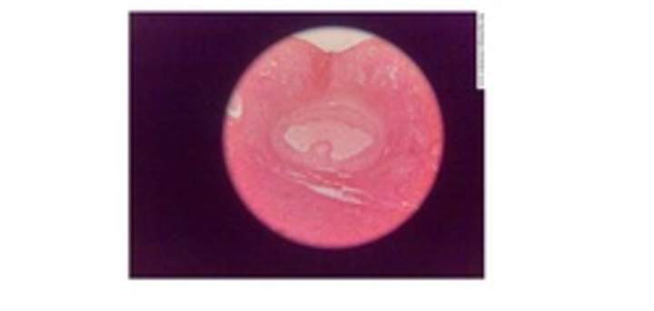 Imagen histológica de ovarios Imagen histológica de ovarios