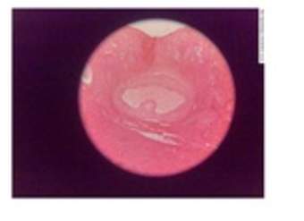 Imagen histológica de ovarios Imagen histológica de ovarios