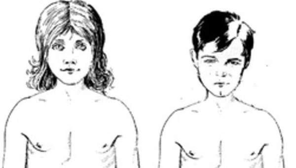 Cuerpo de niños púberes Cuerpo de niños púberes