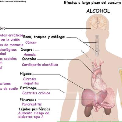Imagen con información sobre los efectos a largo plazo del alcohol Imagen con información sobre los efectos a largo plazo del alcohol