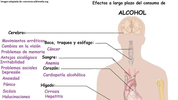 Imagen con información sobre los efectos a largo plazo del alcohol Imagen con información sobre los efectos a largo plazo del alcohol