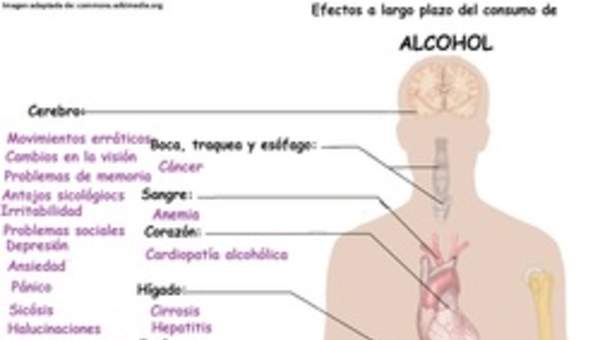 Imagen con información sobre los efectos a largo plazo del alcohol Imagen con información sobre los efectos a largo plazo del alcohol