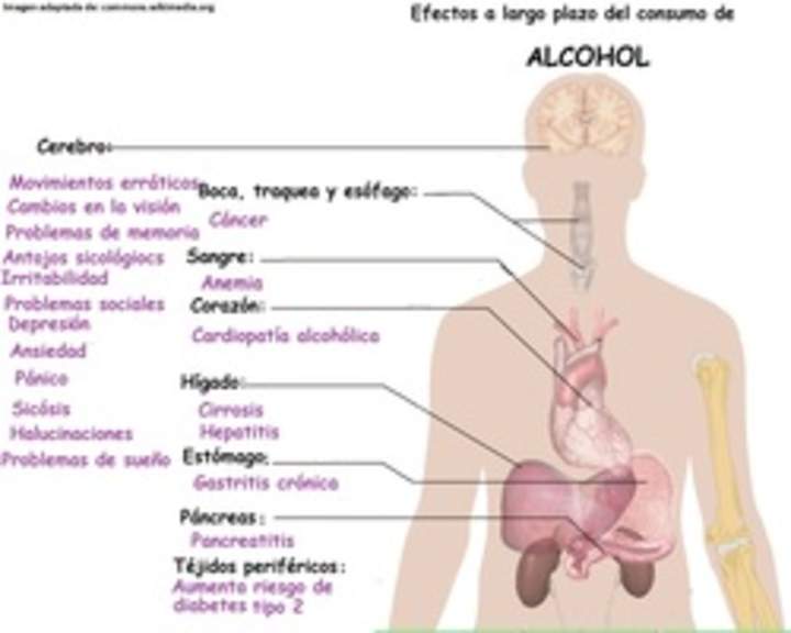 Imagen con información sobre los efectos a largo plazo del alcohol Imagen con información sobre los efectos a largo plazo del alcohol