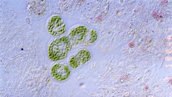 Microscopia de bacterias Microscopia de bacterias