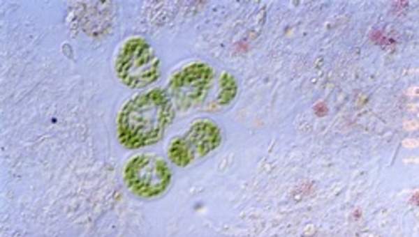 Microscopia de bacterias Microscopia de bacterias