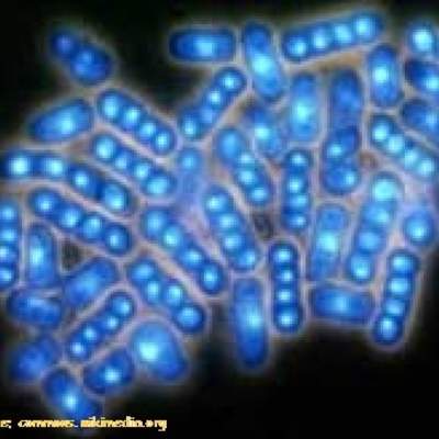 Levaduras al microscopio Levaduras al microscopio