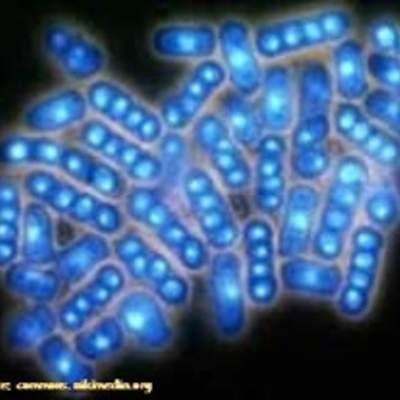 Levaduras al microscopio Levaduras al microscopio