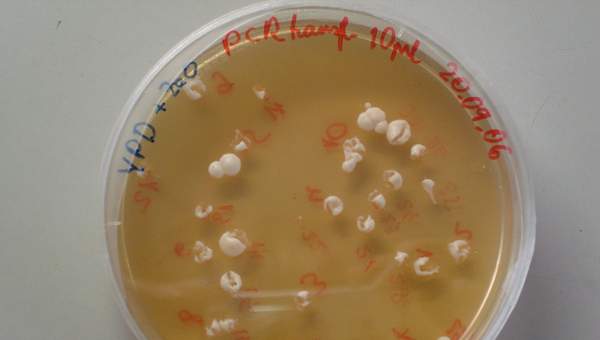Levaduras en placa Levaduras en placa
