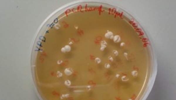 Levaduras en placa Levaduras en placa