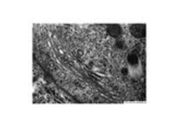 Aparato de Golgi Aparato de Golgi