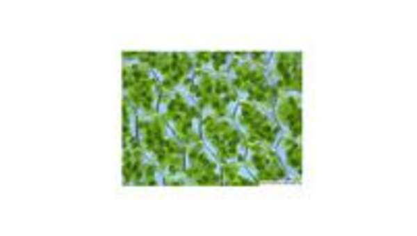 Cloroplastos Cloroplastos