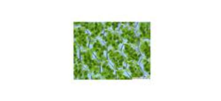 Cloroplastos Cloroplastos