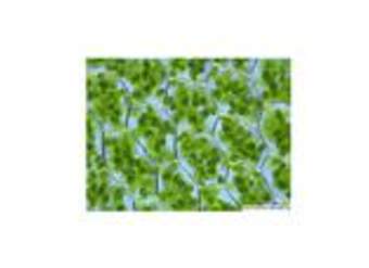 Cloroplastos Cloroplastos