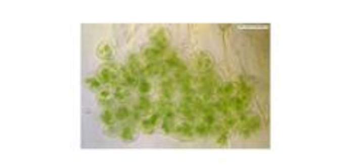 Cloroplastos Cloroplastos