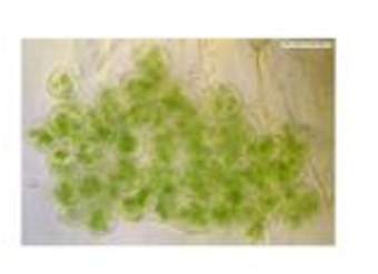 Cloroplastos Cloroplastos