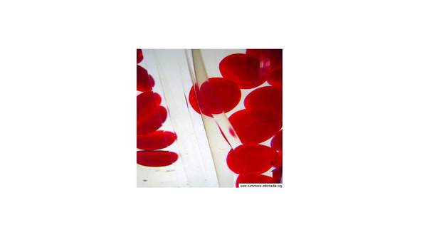 Glóbulos rojos Glóbulos rojos