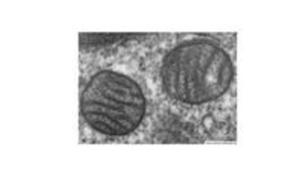 Mitocondria de pulmón Mitocondria de pulmón