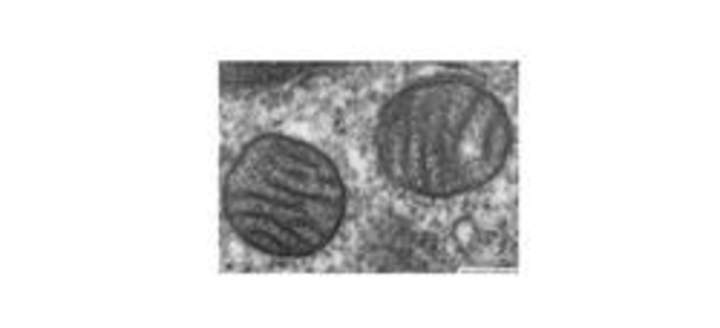 Mitocondria de pulmón Mitocondria de pulmón