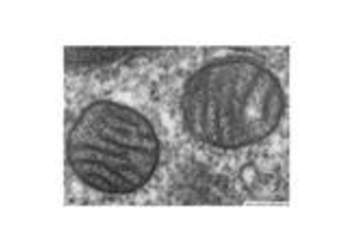 Mitocondria de pulmón Mitocondria de pulmón