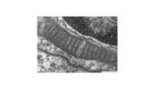 Mitocondria Mitocondria