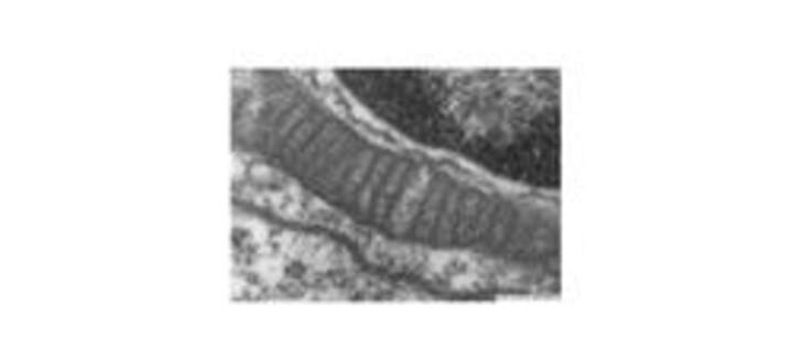 Mitocondria Mitocondria