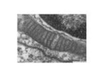 Mitocondria Mitocondria