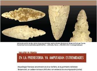 En la prehistoria ya amputaban extremidades En la prehistoria ya amputaban extremidades