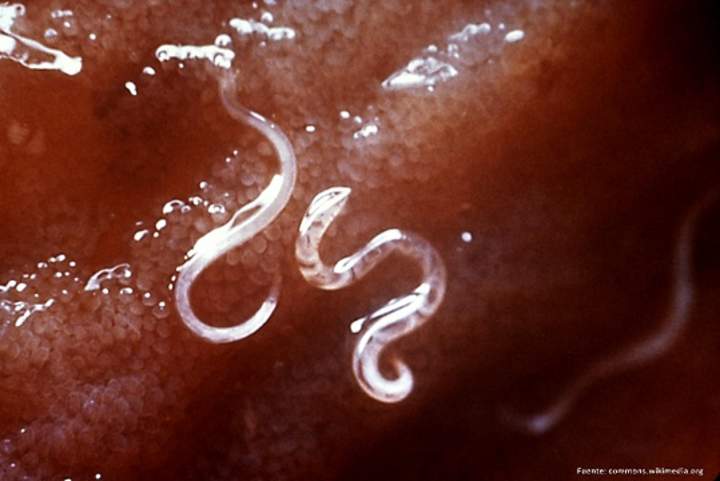 Parasitismo gusanos intestinales Parasitismo gusanos intestinales