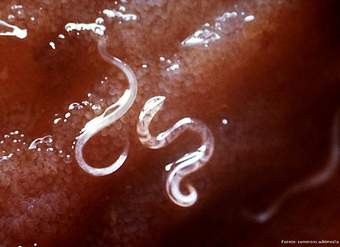 Parasitismo gusanos intestinales Parasitismo gusanos intestinales