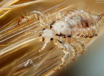 Parasitismo piojo en cabeza humana Parasitismo piojo en cabeza humana