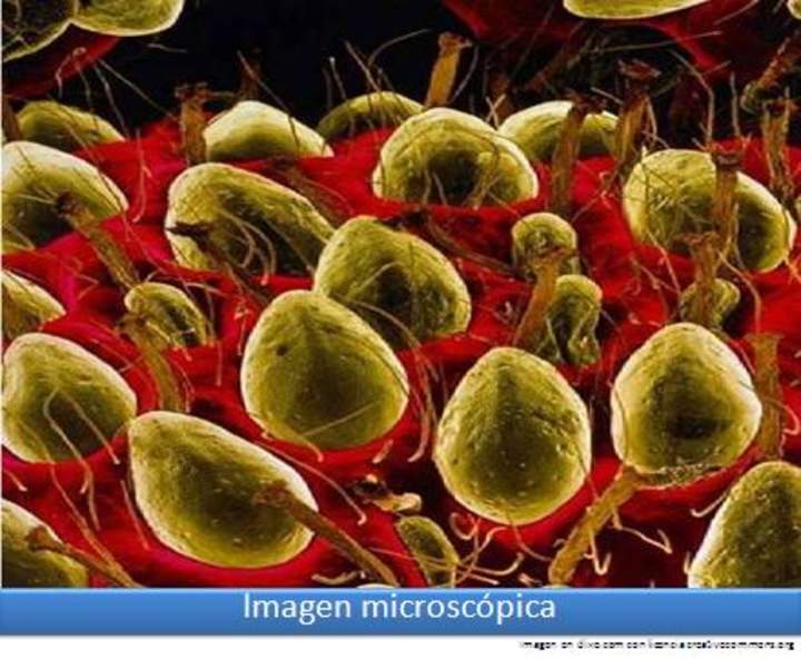 Imagen microscópica 3 Imagen microscópica 3
