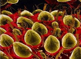 Imagen microscópica 3 Imagen microscópica 3