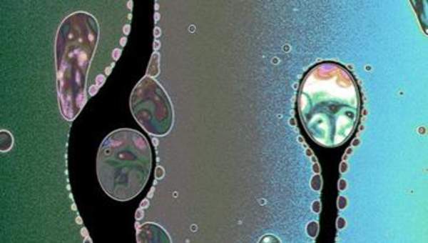 Imagen microscópica 4 Imagen microscópica 4