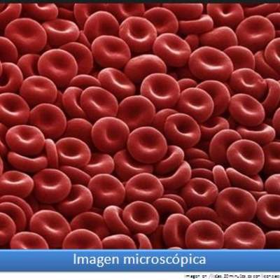 Imagen microscópica 6 Imagen microscópica 6