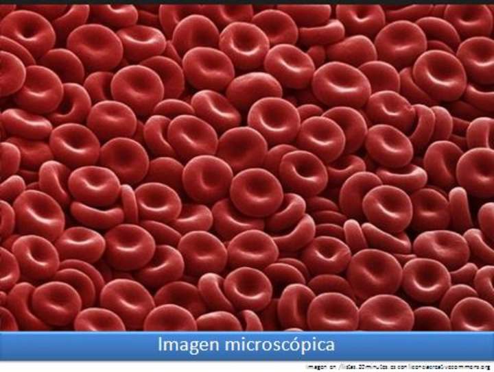 Imagen microscópica 6 Imagen microscópica 6