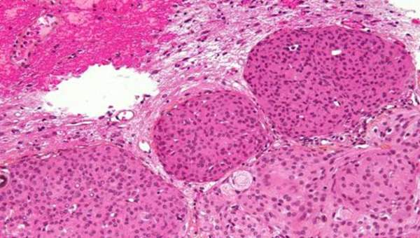 Imagen microscópica 9 Imagen microscópica 9