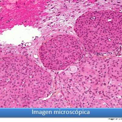Imagen microscópica 9 Imagen microscópica 9