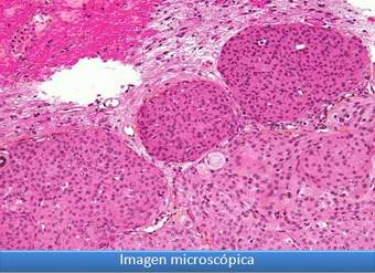 Imagen microscópica 9 Imagen microscópica 9