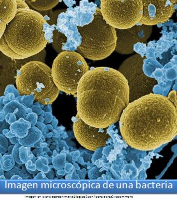 Imagen microscópica de una bacteria Imagen microscópica de una bacteria