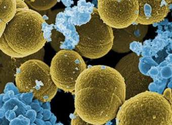 Imagen microscópica de una bacteria Imagen microscópica de una bacteria