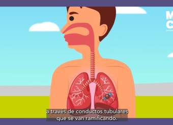 Video Árbol bronquial